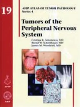 Antonescu |  Tumors of the Peripheral Nervous System | Buch |  Sack Fachmedien