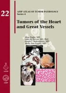 Burke |  Tumors of the Heart and Great Vessels | Buch |  Sack Fachmedien