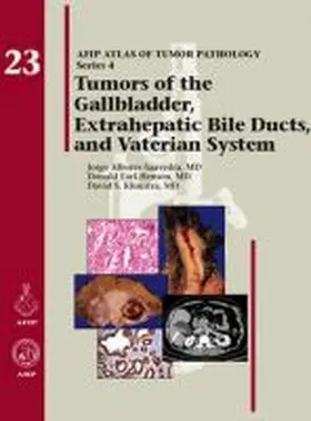 Albores-Saavedra |  Tumors of the Gallbladder, Extrahepatic Bile Ducts, and Vaterian System | Buch |  Sack Fachmedien
