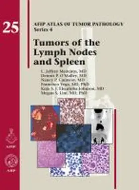 Medeiros |  Tumors of the Lymph Nodes and Spleen | Buch |  Sack Fachmedien