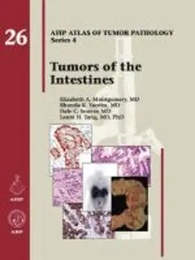 Montgomery |  Tumors of the Intestines | Buch |  Sack Fachmedien