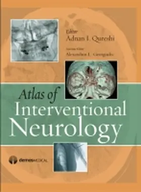 Qureshi / Georgiadis |  Atlas of Interventional Neurology | Buch |  Sack Fachmedien
