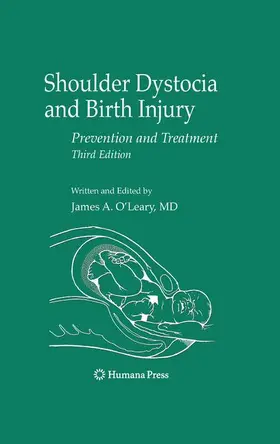 O'Leary | Shoulder Dystocia and Birth Injury | Buch | 978-1-934115-28-2 | www.sack.de