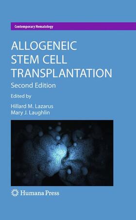 Lazarus / Laughlin | Allogeneic Stem Cell Transplantation | Buch | 978-1-934115-33-6 | sack.de