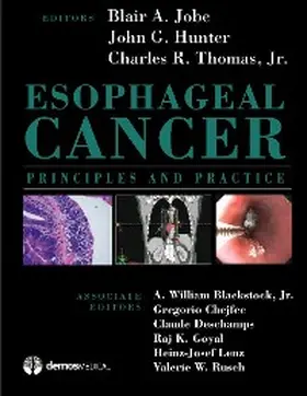 Charles / Hunter / Jobe |  Esophageal Cancer | eBook | Sack Fachmedien