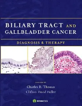Fuller / Thomas |  Biliary Tract and Gallbladder Cancer | eBook | Sack Fachmedien