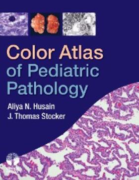 Husain / Stocker | Color Atlas of Pediatric Pathology | E-Book | sack.de