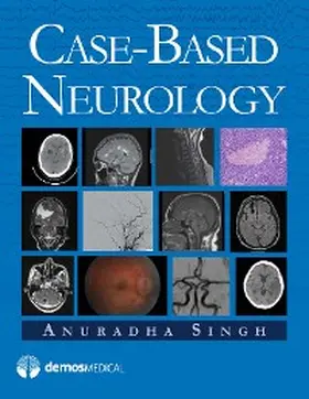 Singh |  Case-Based Neurology | eBook | Sack Fachmedien