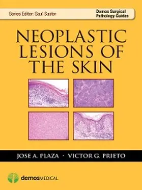Plaza / Prieto |  Neoplastic Lesions of the Skin | eBook | Sack Fachmedien