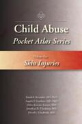 Alexander / Giardino / Esernio-Jenssen |  Child Abuse Pocket Atlas Series Volume 1 | eBook | Sack Fachmedien