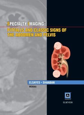 Elsayes / Shaaban | Specialty Imaging: Pitfalls and Classic Signs of the Abdomen and Pelvis | Buch | 978-1-937242-18-3 | sack.de