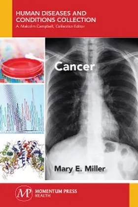 Miller |  Cancer | eBook | Sack Fachmedien