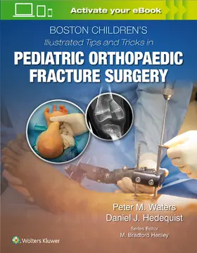Waters / Hedequist |  Boston Children's Illustrated Tips and Tricks  in Pediatric Orthopaedic Fracture Surgery | Buch |  Sack Fachmedien