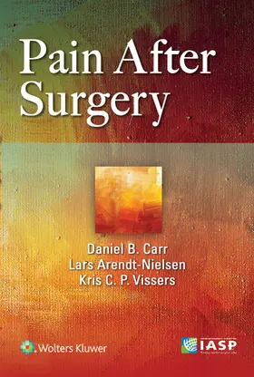 Carr |  Pain After Surgery | Buch |  Sack Fachmedien