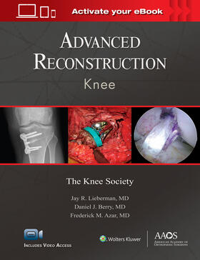 Lieberman / Berry / Azar |  Advanced Reconstruction Knee | Buch |  Sack Fachmedien
