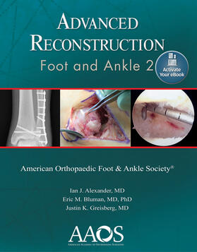 Alexander / Bluman / Greisberg |  Alexander, I: Advanced Reconstruction: Foot and Ankle 2: Pri | Buch |  Sack Fachmedien