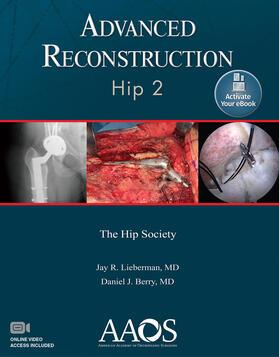 Lieberman / Berry |  Advanced Reconstruction: Hip 2: Print + Ebook with Multimedi | Buch |  Sack Fachmedien