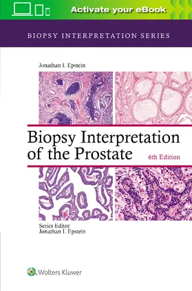 Epstein |  Biopsy Interpretation of the Prostate | Buch |  Sack Fachmedien
