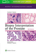 Epstein |  Biopsy Interpretation of the Prostate | Buch |  Sack Fachmedien