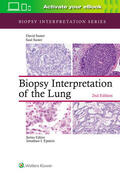 Suster |  Biopsy Interpretation of the Lung | Buch |  Sack Fachmedien