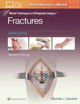 Gardner |  Master Techniques in Orthopaedic Surgery: Fractures | Buch |  Sack Fachmedien