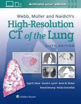 Desai / Lynch / Elicker | Webb, Muller and Naidich's High Resolution of Lung CT | Buch | 978-1-975144-43-2 | sack.de
