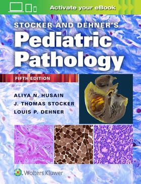Husain / Dehner | Stocker and Dehner's Pediatric Pathology | Buch | 978-1-975144-81-4 | sack.de