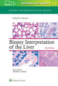 Torbenson |  Biopsy Interpretation of the Liver | Buch |  Sack Fachmedien