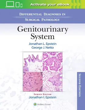 Epstein / Netto |  Differential Diagnoses in Surgical Pathology | Buch |  Sack Fachmedien