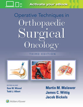 Malawer |  Malawer, M: Operative Techniques in Orthopaedic Surgical Onc | Buch |  Sack Fachmedien