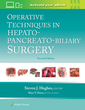 Hughes |  Operative Techniques in Hepato-Pancreato-Biliary Surgery: Print + eBook with Multimedia | Buch |  Sack Fachmedien