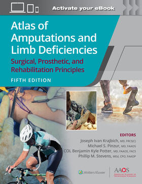 Krajbich / Pinzur / Potter |  Atlas of Amputations and Limb Deficiencies | Buch |  Sack Fachmedien