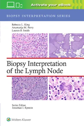 Perry / King / Smith |  Biopsy Interpretation of the Lymph Node: Print + eBook with Multimedia | Buch |  Sack Fachmedien
