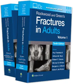 Ollivere / Tornetta / McKee |  Rockwood and Green's Fractures in Adults: Print + eBook with Multimedia. 2 Bände | Buch |  Sack Fachmedien