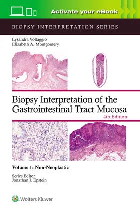 VOLTAGGIO / MONTGOMERY |  Biopsy Interpretation of the Gastrointestinal Tract Mucosa Volume 1 | Buch |  Sack Fachmedien