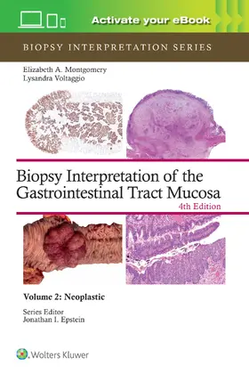 MONTGOMERY / VOLTAGGIO |  Biopsy Interpretation of the Gastrointestinal Tract Mucosa Volume 2 | Buch |  Sack Fachmedien