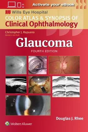 Rhee | Glaucoma | Buch | 978-1-9752-1481-4 | sack.de