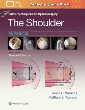 WILLIAMS / RAMSEY |  Master Techniques in Orthopaedic Surgery: The Shoulder: Print + eBook with Multimedia | Buch |  Sack Fachmedien