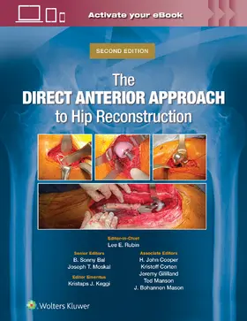 Rubin / Bal / Moskal | The Direct Anterior Approach to Hip Reconstruction | Buch | 978-1-9752-2197-3 | www.sack.de