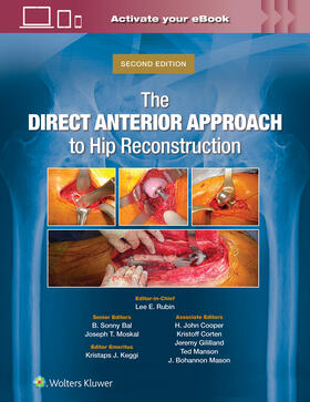 Rubin / Bal / Moskal | Rubin, L: Direct Anterior Approach to Hip Reconstruction | Buch | 978-1-975221-97-3 | sack.de