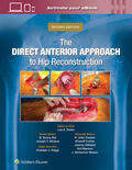 Rubin / Bal / Moskal |  Rubin, L: Direct Anterior Approach to Hip Reconstruction | Buch |  Sack Fachmedien