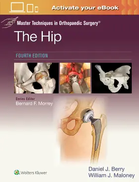 BERRY / MALONEY / Berry |  Master Techniques in Orthopaedic Surgery: The Hip: Print + eBook with Multimedia | Buch |  Sack Fachmedien