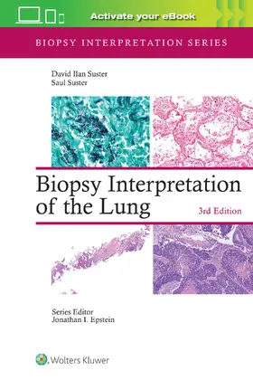 SUSTER |  Biopsy Interpretation of the Lung | Buch |  Sack Fachmedien
