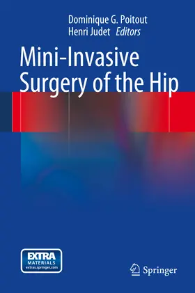 Poitout / Judet |  Mini-Invasive Surgery of the Hip | eBook | Sack Fachmedien