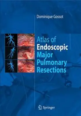Gossot | Atlas of endoscopic major pulmonary resections | Buch | 978-2-287-99776-1 | www.sack.de