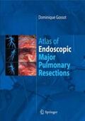 Gossot |  Atlas of endoscopic major pulmonary resections | Buch |  Sack Fachmedien