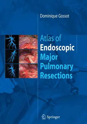 Gossot | Atlas of endoscopic major pulmonary resections | E-Book | www.sack.de