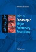 Gossot |  Atlas of endoscopic major pulmonary resections | eBook | Sack Fachmedien