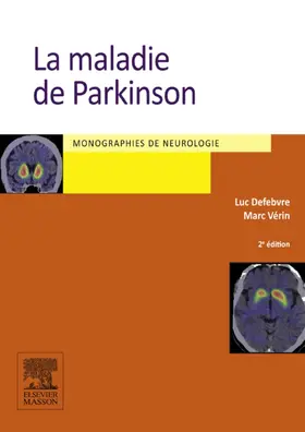 Defebvre / Vérin |  La maladie de Parkinson | eBook | Sack Fachmedien