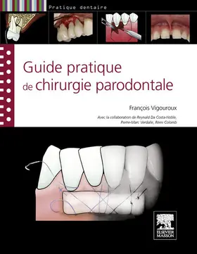 Vigouroux |  Guide pratique de chirurgie parodontale | eBook | Sack Fachmedien